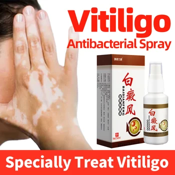 Lékařské Vitiligo Sprej Leukoplakie Onemocnění Repair Liquid Dermalight Léčba Vitiligo Podpora Kožní Pigment Melanin Péče