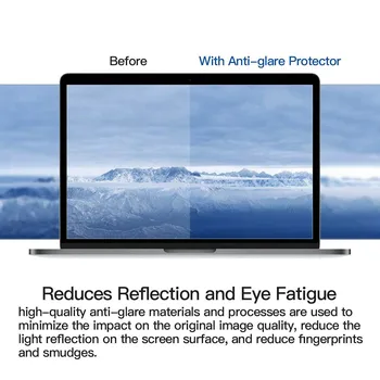 KK A LL Pro Apple Macbook Pro Macbook retina12 palcový Model A1534 Crystal Clear Lcd Stráže Film Screen Protector film