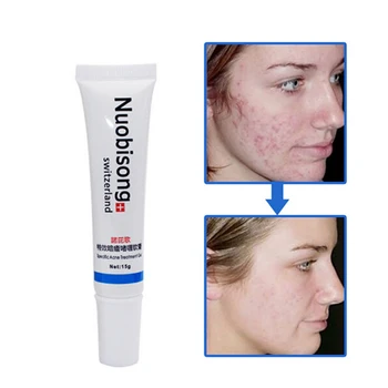 3ks/lot Nuobisong Konkrétní Léčba Akné Gel, péče o Obličej účinně odstranit pupínky bez podráždění