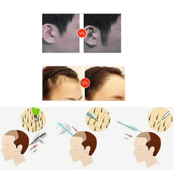 FUE Vlasy Folikulu Extractor Scarless Lysé Léčba Implantované Vlasy Výsadbu Vlasy, Obočí Make-up Nástroje